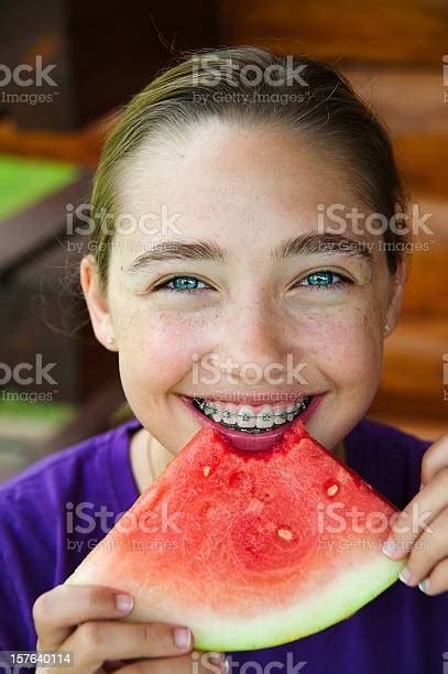 Portrait Of Girl With Blue Eyes And Braces Eating Watermelon Stock