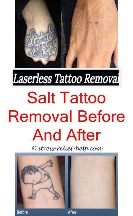 Once it is soaked, scrub the tattooed area with the washcloth. tattoo lightening lemon and salt tattoo removal - does ...