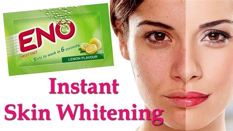 Skin Whitening Treatment Naturally Instant Fairness Treatment With