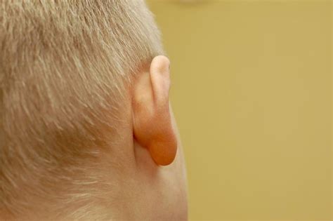 Lumps Behind The Ear Causes And When To See A Doctor Cyst Acne Ear