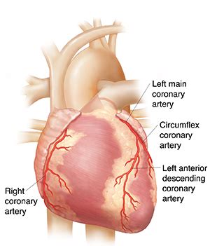 Coronary Artery Disease Saint Luke S Health System