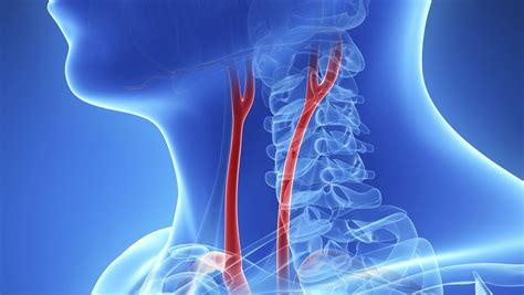 Cooper Connection Blocked Carotid Arteries Lead To Stroke