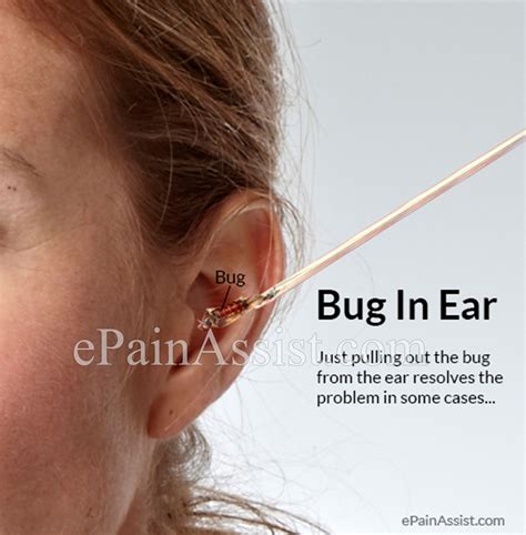 You do not always need to see a gp for an ear infection as they often get better on their. GAF help me unclog my ear - NeoGAF