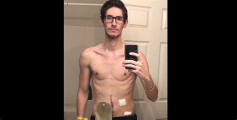 This Skinny Guy Bulked Up And Sculpted A Six Pack In 7 Months Health910