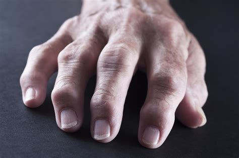Finger Pain Causes Treatment And Self Care