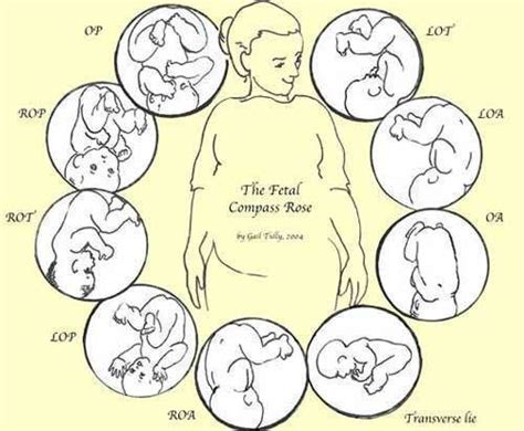 Optimal Fetal Positioning For A Better Birth Baby Position Spinning