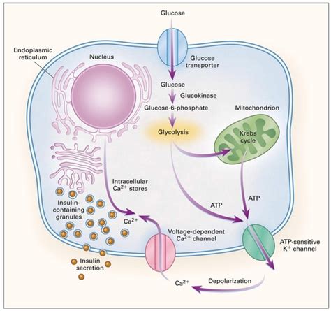 Diabetes Mellitus Congenital Neonatal