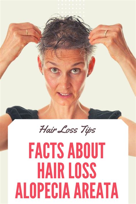 Facts About Hair Loss Alopecia Areata Complete Makeover
