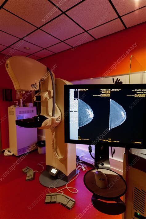 Contrast Enhanced Digital Mammography Stock Image C0328550