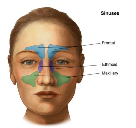 Post Nasal Drip Sinus X Ray