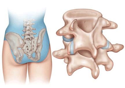 The pain usually results from problems with the musculoskeletal system—most the spine (spinal column) consists of back bones (vertebrae). Anatomy of the Spine -Redlands, Loma Linda, Highland | Bones and Spine Surgery Inc.