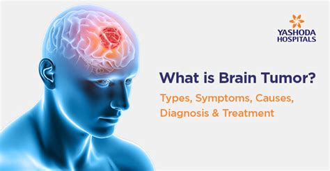 What Is Brain Tumor Types Symptoms Causes Diagnosis And Treatment