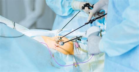 Laparoscopic Surgery Purpose Procedure And Benefits