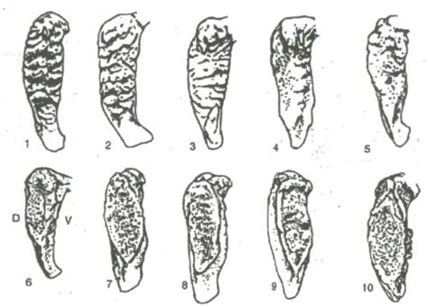 Using Artificial Intelligence And The Analysis Of The Pubic Symphysis