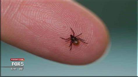 Hundreds On Long Island Develop Red Meat Allergy From Tick Bites