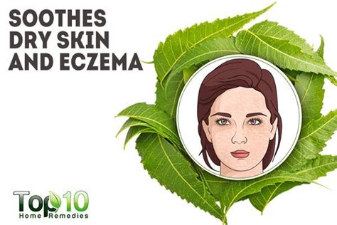 Soothes Dry Skin And Eczema Top 10 Home Remedies