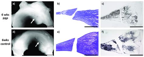 Check spelling or type a new query. a) + d): Macroscopic view of a lateral meniscus of New ...