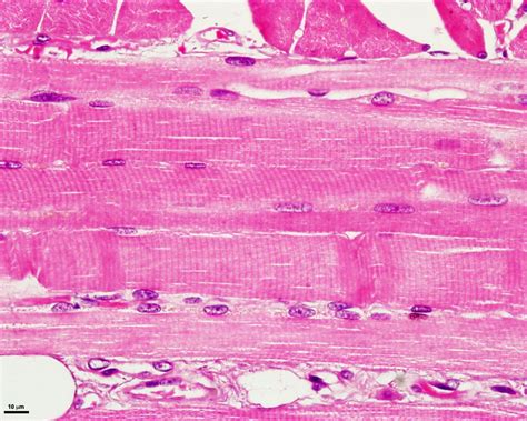 Skeletal muscles differ in function and structure. Skeletal Muscle Tissue Under Microscope Labeled - Micropedia