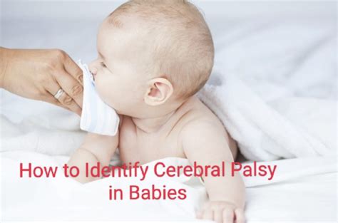 How To Identify Cerebral Palsy In Babies World