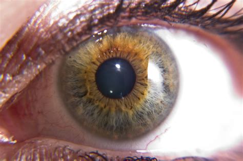Example Of Primarily Green Eye With Central Heterochromia Central