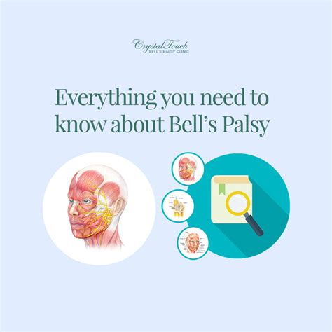 Full Bell S Palsy Video Collection Everything You Need To Know My Xxx