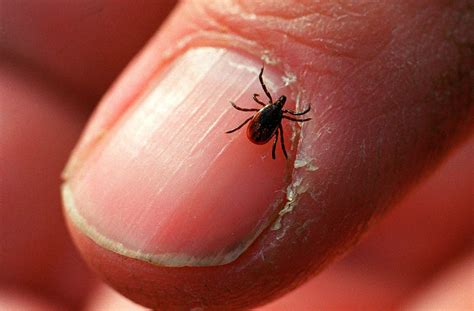 Ticks Suck Heres A Guide To Identifying Them And Avoiding Bites Mpr