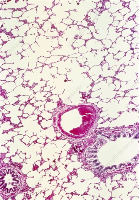 Lm Of A Cross Section Through Lung Tissue Stock Image P5900172