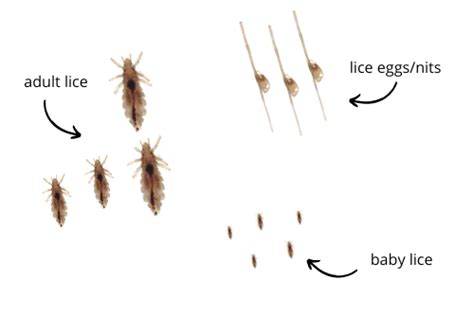 Will Uv Light Kill Head Lice Shelly Lighting