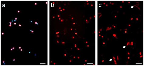 Mcc begins in these cells. Immunofluorescence on selected Merkel cells in culture. (a ...