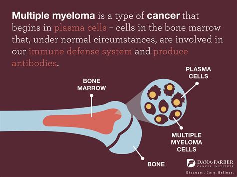 What Is Multiple Myeloma What Is Multiple Myeloma