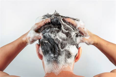Heres How To Really Deal With Dandruff