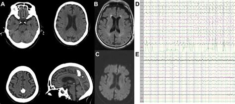 Results Of Brain Computed Tomography Ct Magnetic Resonance Imaging Download Scientific