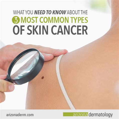 The 3 Most Common Types Of Skin Cancer