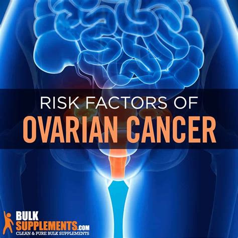Ovarian Cancer Risk Factors Symptoms And Treatment