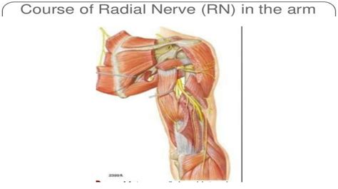 Solution Radial Nerve Palsy Opptx Studypool