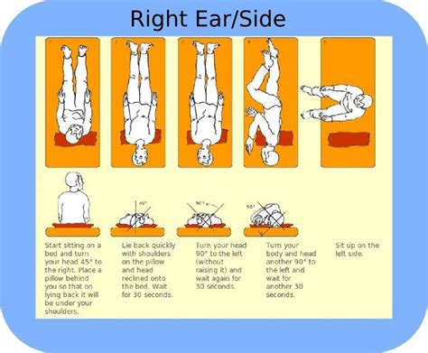 Image Result For Epley Maneuver Patient Handout With