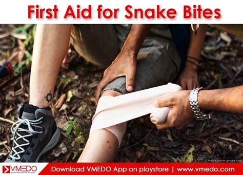 First Aid For Snake Bite With Pictures Snake Poin