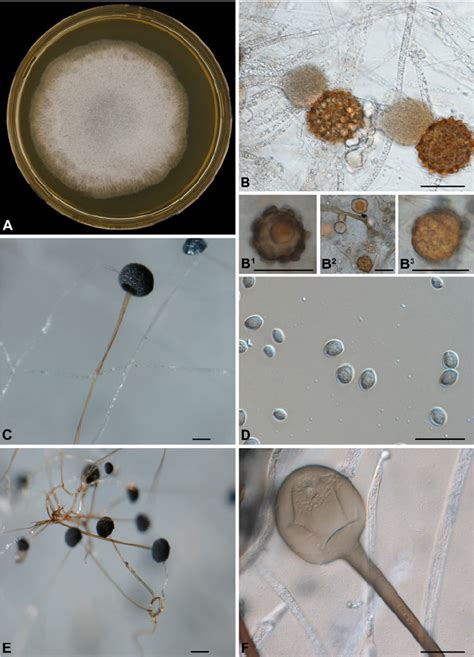 Macroscopic And Microscopic Morphology Of Rhizopus Microsporus Cbs