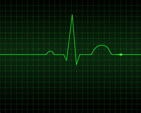 Electrocardiograms Ekgsecgs How It Works Stepwards