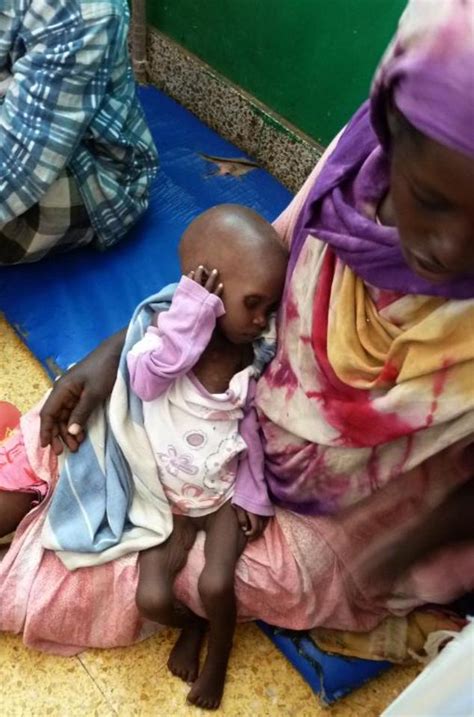 Over 38000 Somali Children Facing Starvation Un Daily Mail Online