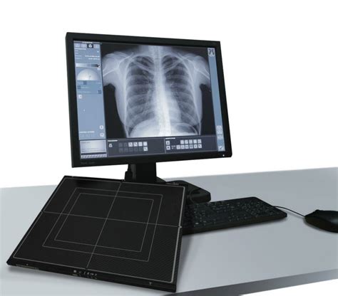 Avanse Dr Digital Radiography Retrofit Wolverson X Ray Ltd