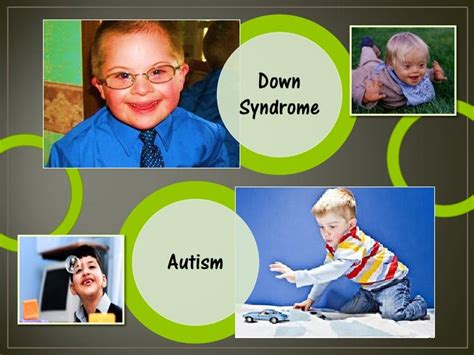 Autism And Down Syndrome