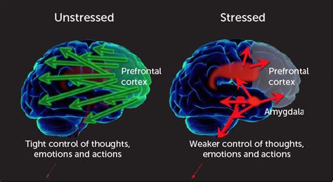 How Stress Affects Your Brain