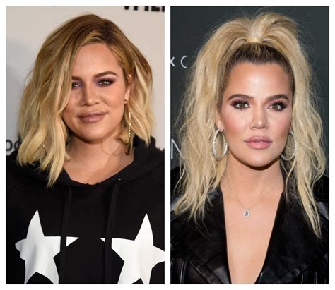Did Khloé Kardashian Get A Nose Job Plastic Surgeon Weighs In