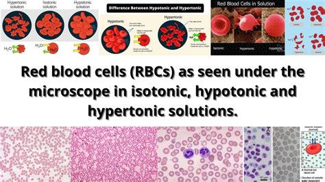 Red Blood Cells Rbcs As Seen Under The Microscope In Isotonic