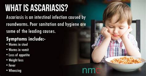 Ascariasis Causes Symptoms Signs Diagnosis Treatment