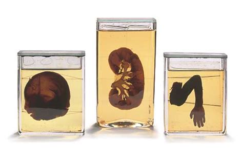 Three Fluid Preserved Specimens Of Human Body Parts Christies