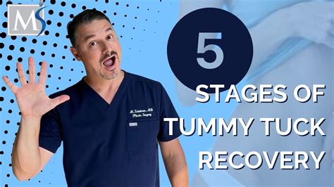 Tummy Tuck Recovery 5 Stages Youtube