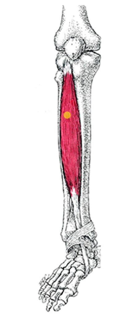 Tibialis Anteriormuskeltrg Zone44