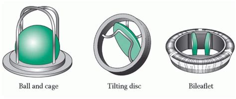 Mechanical Aortic Heart Valve